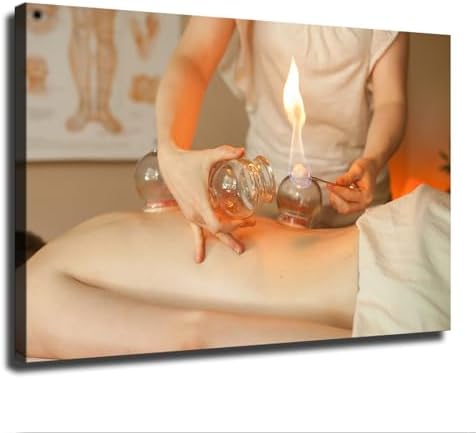 Chinese Medicine Cupping Spa Art Poster Canvas 16x24 Framed Wall Art