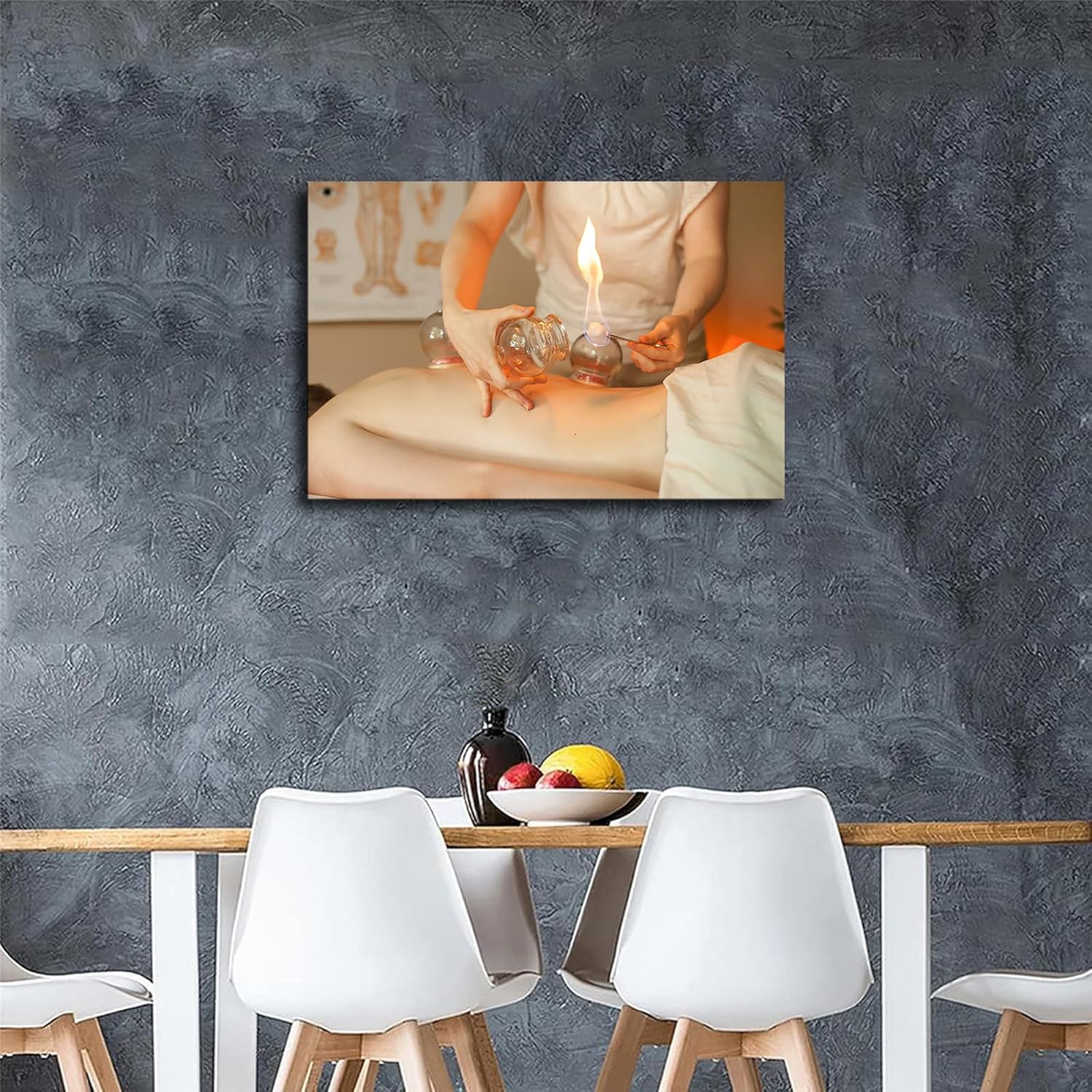 Chinese Medicine Cupping Spa Art Poster Canvas 16x24 Framed Wall Art